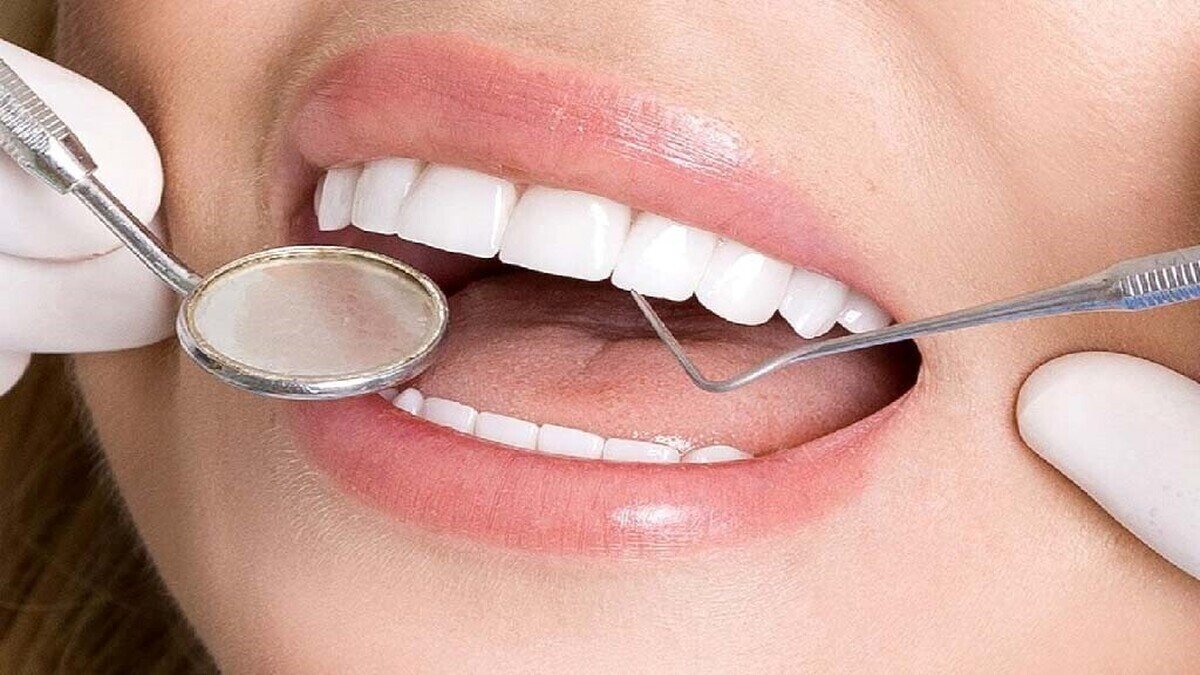 هزینه ایمپلنت دندان با بیمه چقدر است؟